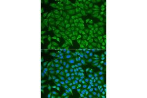 Immunofluorescence analysis of U2OS cells using PIP antibody (ABIN6131693, ABIN6145670, ABIN6145672 and ABIN6222022). (PIP antibody  (AA 29-146))