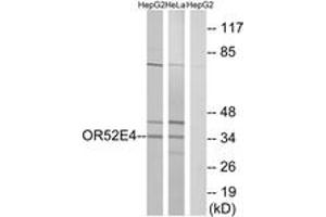 Western blot analysis of extracts from HepG2/HeLa cells, using OR52E4 Antibody.