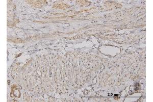 Immunoperoxidase of monoclonal antibody to CXCL5 on formalin-fixed paraffin-embedded human smooth muscle. (CXCL5 antibody  (AA 1-114))