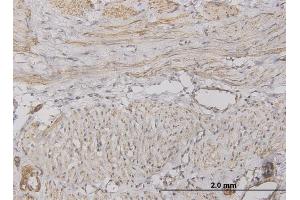 Immunoperoxidase of monoclonal antibody to CXCL5 on formalin-fixed paraffin-embedded human smooth muscle.