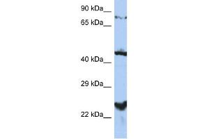 WB Suggested Anti-MRS2L Antibody Titration:  0. (MRS2 antibody  (Middle Region))