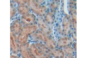 Figure. (AATF antibody  (AA 237-523))