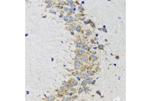 Immunohistochemistry of paraffin-embedded rat brain using CDK1 antibody. (CDK1 antibody)