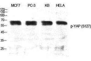 Western Blot (WB) analysis of specific cells using Phospho-YAP (S127) Polyclonal Antibody.