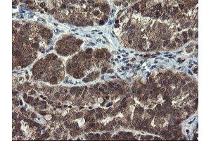 Immunohistochemistry (IHC) image for anti-Myeloid Leukemia Factor 1 (MLF1) antibody (ABIN1499496) (MLF1 antibody)