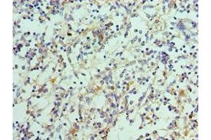 Immunohistochemistry of paraffin-embedded human spleen tissue using ABIN7156850 at dilution of 1:100 (IL-21 antibody  (AA 25-162))