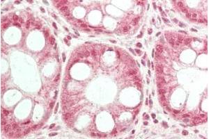 Immunohistochemistry (IHC) image for anti-Transient Receptor Potential Cation Channel, Subfamily C, Member 6 (TRPC6) (Internal Region) antibody (ABIN1019676)