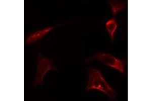 ABIN6278128 staining LOVO cells by IF/ICC.