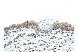 RBMS1 antibody was used for immunohistochemistry at a concentration of 4-8 ug/ml to stain Squamous epithelial cells (arrows) in Human Skin. (RBMS1 antibody  (C-Term))