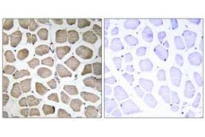Immunohistochemistry analysis of paraffin-embedded human skeletal muscle tissue using MOT12 Antibody . (SLC16A12 antibody)