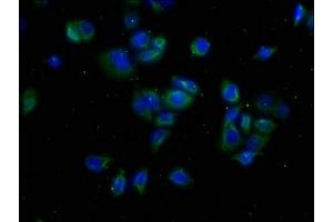 Immunofluorescence staining of PC-3 cells with ABIN7175608 at 1:50, counter-stained with DAPI. (CACNA1A antibody  (AA 1838-2136))