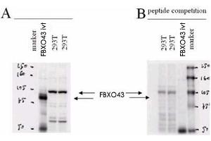Western blot using FBXO43 polyclonal antibody .