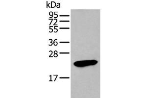 Western blot analysis of Human stomach tissue lysate using GKN1 Polyclonal Antibody at dilution of 1:250 (Gastrokine 1 antibody)