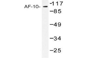 Western blot (WB) analysis of AF-10 antibody in extracts from COLO205 cells. (MLLT10 antibody)