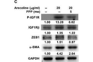 Western Blotting (WB) image for anti-Glyceraldehyde-3-Phosphate Dehydrogenase (GAPDH) antibody (ABIN2857072)