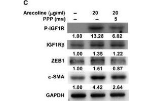 Western Blotting (WB) image for anti-Glyceraldehyde-3-Phosphate Dehydrogenase (GAPDH) antibody (ABIN2857072)