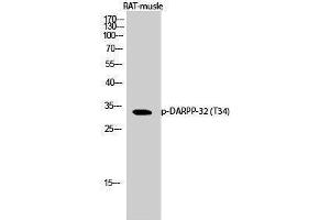 Western Blotting (WB) image for anti-Protein Phosphatase 1, Regulatory (Inhibitor) Subunit 1B (PPP1R1B) (pThr34) antibody (ABIN3179790) (DARPP32 antibody  (pThr34))
