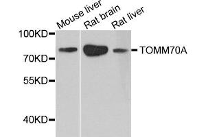Western blot analysis of extract of various cells, using TOM70 antibody. (TOM70 antibody)