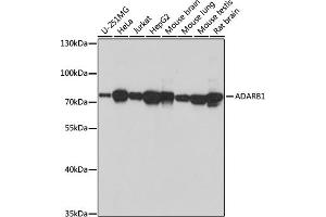 Western blot analysis of extracts of various cell lines, using  antibody (ABIN7265459) at 1:1000 dilution. (RED1 antibody  (AA 180-380))