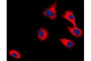 Immunofluorescent analysis of CADM2 staining in HepG2 cells. (CADM2 antibody)