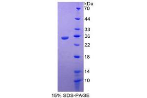 SDS-PAGE (SDS) image for Interleukin 17 Receptor E (IL17RE) (AA 457-630) protein (His tag) (ABIN1877510)