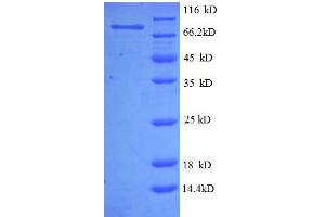 SDS-PAGE (SDS) image for 5'-Nucleotidase, Ecto (CD73) (NT5E) (AA 28-547), (partial) protein (GST tag) (ABIN1046372) (CD73 Protein (AA 28-547, partial) (GST tag))