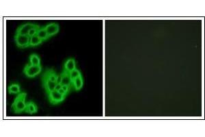 Immunofluorescence analysis of MCF7 cells, using FPR1 Antibody. (FPR1 antibody)