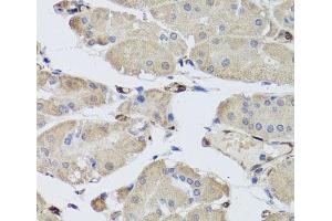 Immunohistochemistry of paraffin-embedded Human stomach using FABP5 Polyclonal Antibody at dilution of 1:100 (40x lens). (FABP5 antibody)