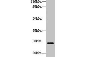 Western blot All lanes: MTHFS antibody at 2 μg/mL + Hela whole cell lysate Secondary Goat polyclonal to rabbit IgG at 1/10000 dilution Predicted band size: 24, 21 kDa Observed band size: 24 kDa