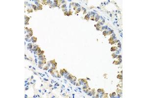 Immunohistochemistry of paraffin-embedded mouse lung using TICAM1 antibody. (TICAM1 antibody  (AA 20-200))