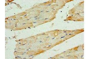 Immunohistochemistry of paraffin-embedded human skeletal muscle tissue using ABIN7171727 at dilution of 1:100 (TRF1 antibody  (AA 260-439))