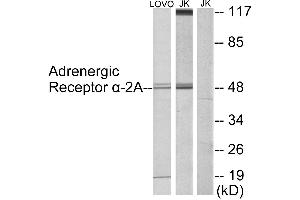 Immunohistochemistry analysis of paraffin-embedded human testis tissue using Adrenergic Receptor α-2A antibody. (ADRA2A antibody  (Internal Region))