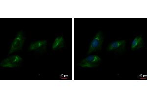 ICC/IF Image Autotaxin antibody detects Autotaxin protein at cytoplasm by immunofluorescent analysis. (ENPP2 antibody  (C-Term))