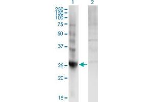 Western Blot analysis of DIRAS3 expression in transfected 293T cell line by DIRAS3 monoclonal antibody (M01A), clone 1G4.