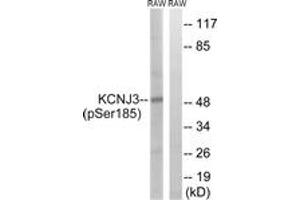 Western blot analysis of extracts from RAW264. (KCNJ3 antibody  (pSer185))