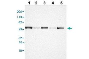 Western blot analysis of Lane 1: RT-4 cell line, Lane 2: U-251MG sp cell line, Lane 3: A-431 cell line, Lane 4: human liver tissue, and Lane 5: human tonsil tissue with LYN polyclonal antibody . (LYN antibody  (AA 7-147))