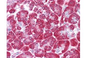 NME1 antibody was used for immunohistochemistry at a concentration of 4-8 ug/ml. (NME1 antibody  (N-Term))