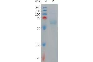 SDS-PAGE (SDS) image for Paired Immunoglobin-Like Type 2 Receptor alpha (PILRA) (AA 20-195) protein (Fc Tag) (ABIN7491469)