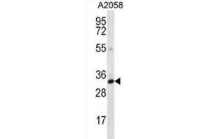 Western Blotting (WB) image for anti-Calponin 2 (CNN2) antibody (ABIN2996730)