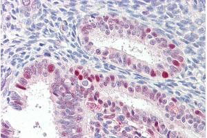 anti-Membrane-Associated Ring Finger (C3HC4) 7, E3 Ubiquitin Protein Ligase (MARCH7) (Internal Region) antibody