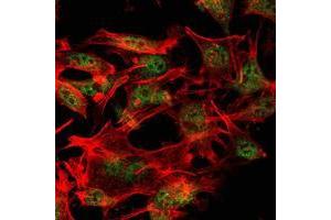 Immunofluorescence analysis of LOVO cells using SETDB1 mouse mAb (green). (SETDB1 antibody)