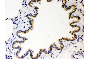 Anti- COMT Picoband antibody, IHC(P) IHC(P): Rat Lung Tissue (COMT antibody  (AA 52-271))
