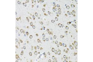 Immunohistochemistry of paraffin-embedded mouse brain using OGDH antibody (ABIN6292773) at dilution of 1:100 (40x lens). (alpha KGDHC antibody)