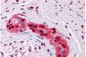 Human Colon, myenteric plexus: Formalin-Fixed, Paraffin-Embedded (FFPE) (SOX9 antibody  (AA 400-510))