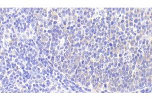 Immunohistochemistry (IHC) image for anti-Phosphoinositide-3-Kinase, Catalytic, beta Polypeptide (PIK3CB) (AA 524-703) antibody (ABIN7436744)