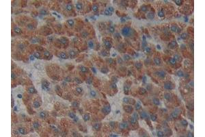 Used in DAB staining on fromalin fixed paraffin- embedded liver tissue (Laminin alpha 1 antibody  (AA 2613-2746))