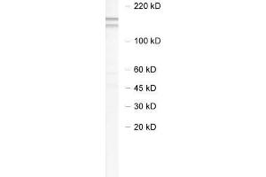 dilution: 1 : 1000, sample: brain homogenate of 5 x FAD mouse (NEDD4-2 antibody)