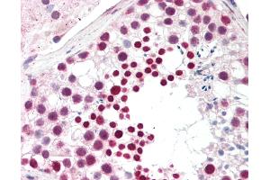 Human Testis: Formalin-Fixed, Paraffin-Embedded (FFPE). (CTAG1B antibody  (C-Term))