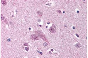 Human Brain, Cortex (formalin-fixed, paraffin-embedded) stained with MARK1 antibody ABIN239803 at 2. (MARK1 antibody  (N-Term))