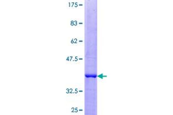 IGF2 Protein (AA 1-113) (GST tag)